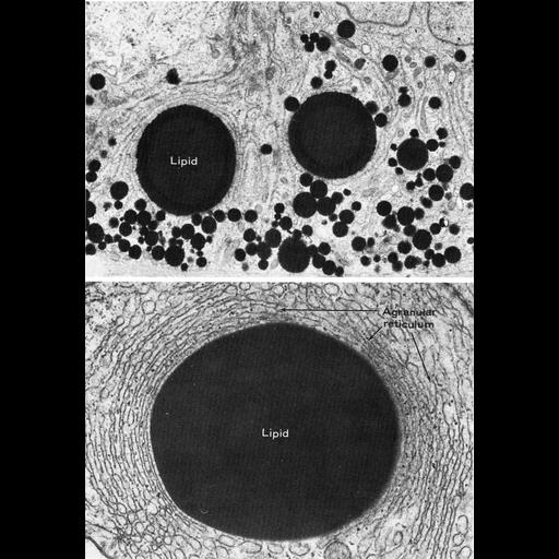 Sertoli cell