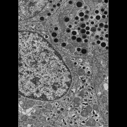 epithelial cell of pancreas