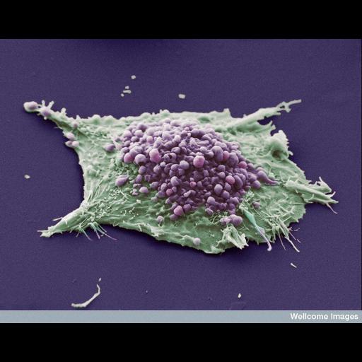 epithelial cell of lung