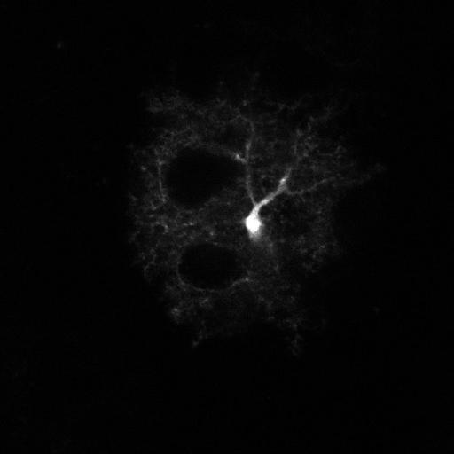 astrocyte