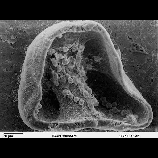 mesenchymal cell