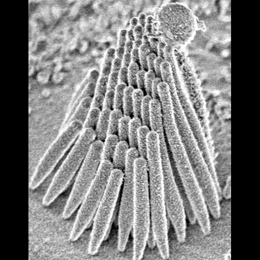 auditory hair cell
