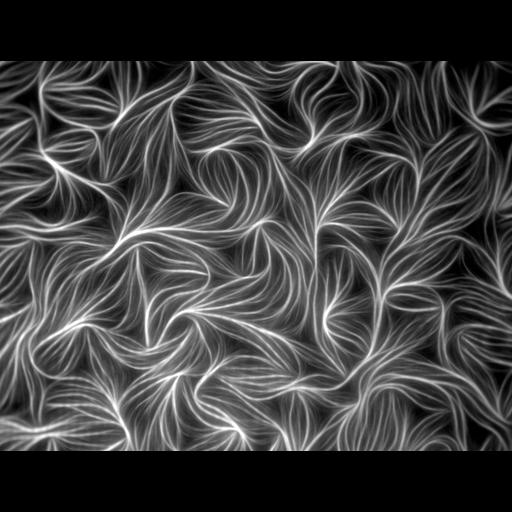 filamentous actin