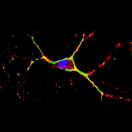 primary striatal neuron