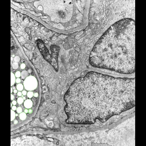 kidney glomerular epithelial cell
