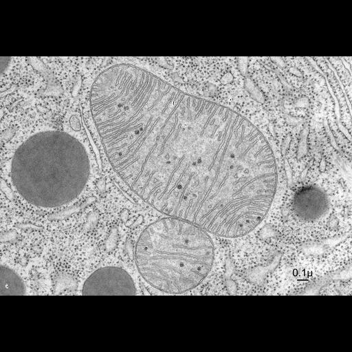 pancreatic cell
