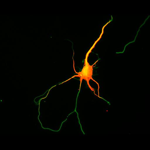 multipolar neuron